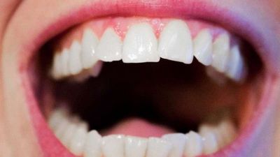 Tips Sederhana Untuk Gusi Sehat Kunjungan ke dokter gigi